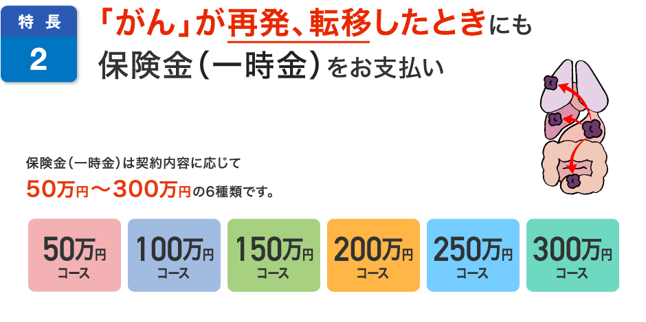 特長2 「がん」が再発、転移したときにも保険金（一時金）をお支払い