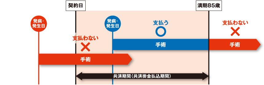 手術により共済金を支払う場合について