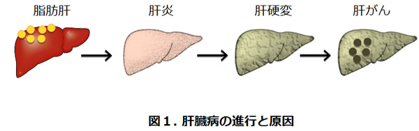 肝 は 脂肪 と