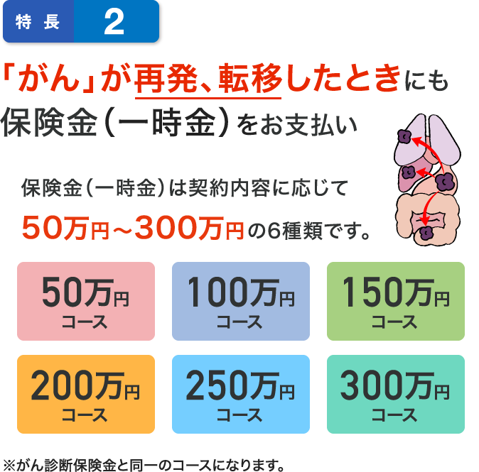 特長2 「がんの再発、転移が生じたときにも保険金をお支払い